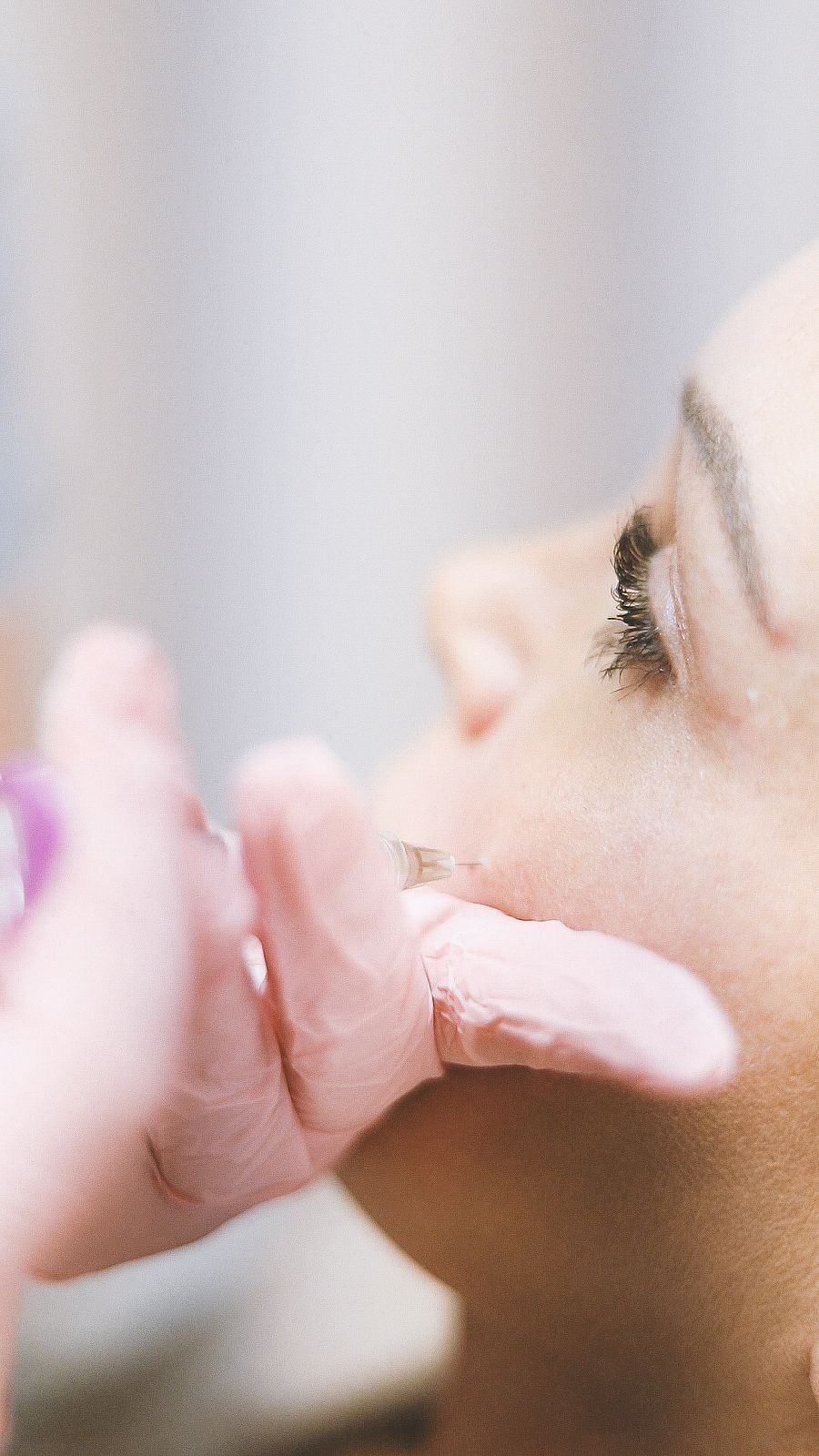 PRF skin rejuvenation