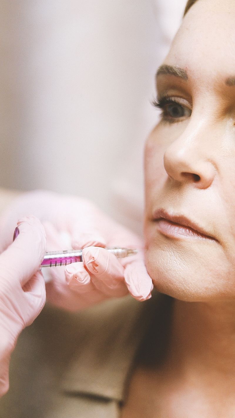 Sculptra volumizing treatment