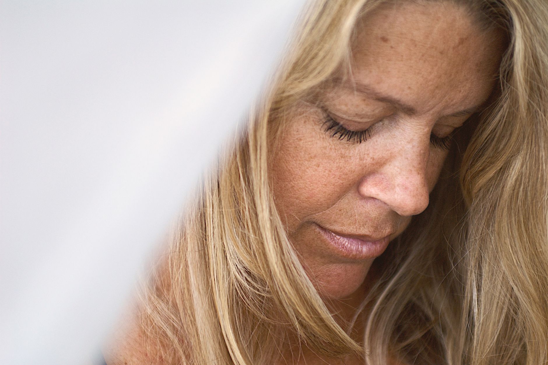 close-up of rosacea-prone skin showing redness and sensitivity before a dermatologist-recommended skincare routine