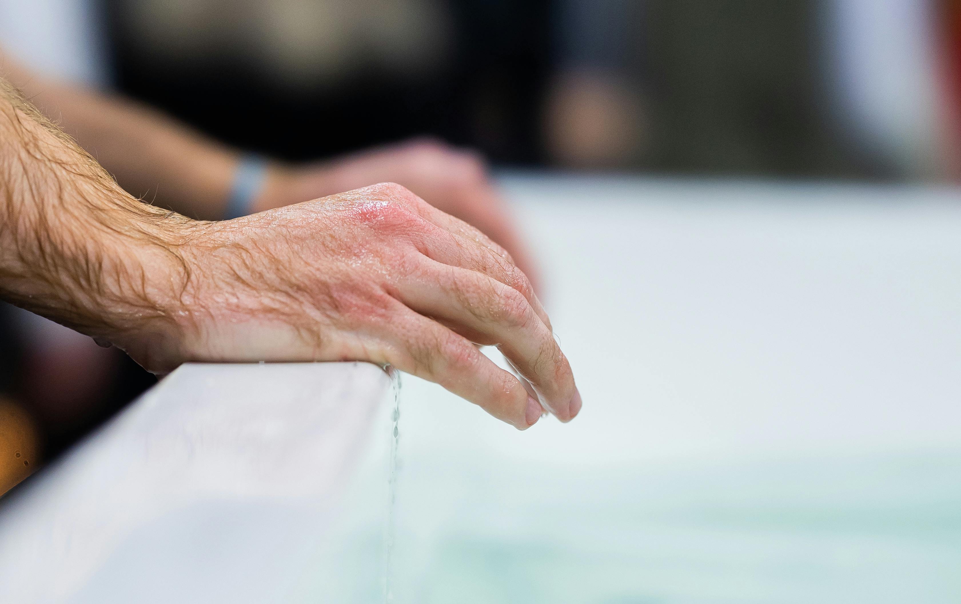 Why Do Dogs Have Wet Noses? Discover This Fascinating Truth! 9 How to Care for Your Dog’s Nose: Tips for Maintaining Optimal Moisture Levels