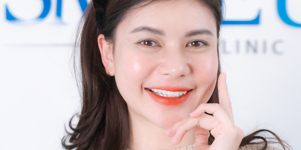 Trám răng thẩm mỹ là một thủ thuật phục hình răng được sử dụng để cải thiện vẻ ngoài của răng