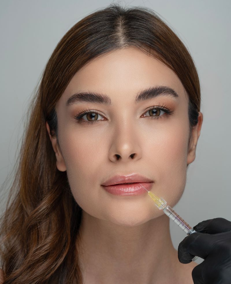 Tratamiento de aumento y perfilado de labios con ácido hialurónico