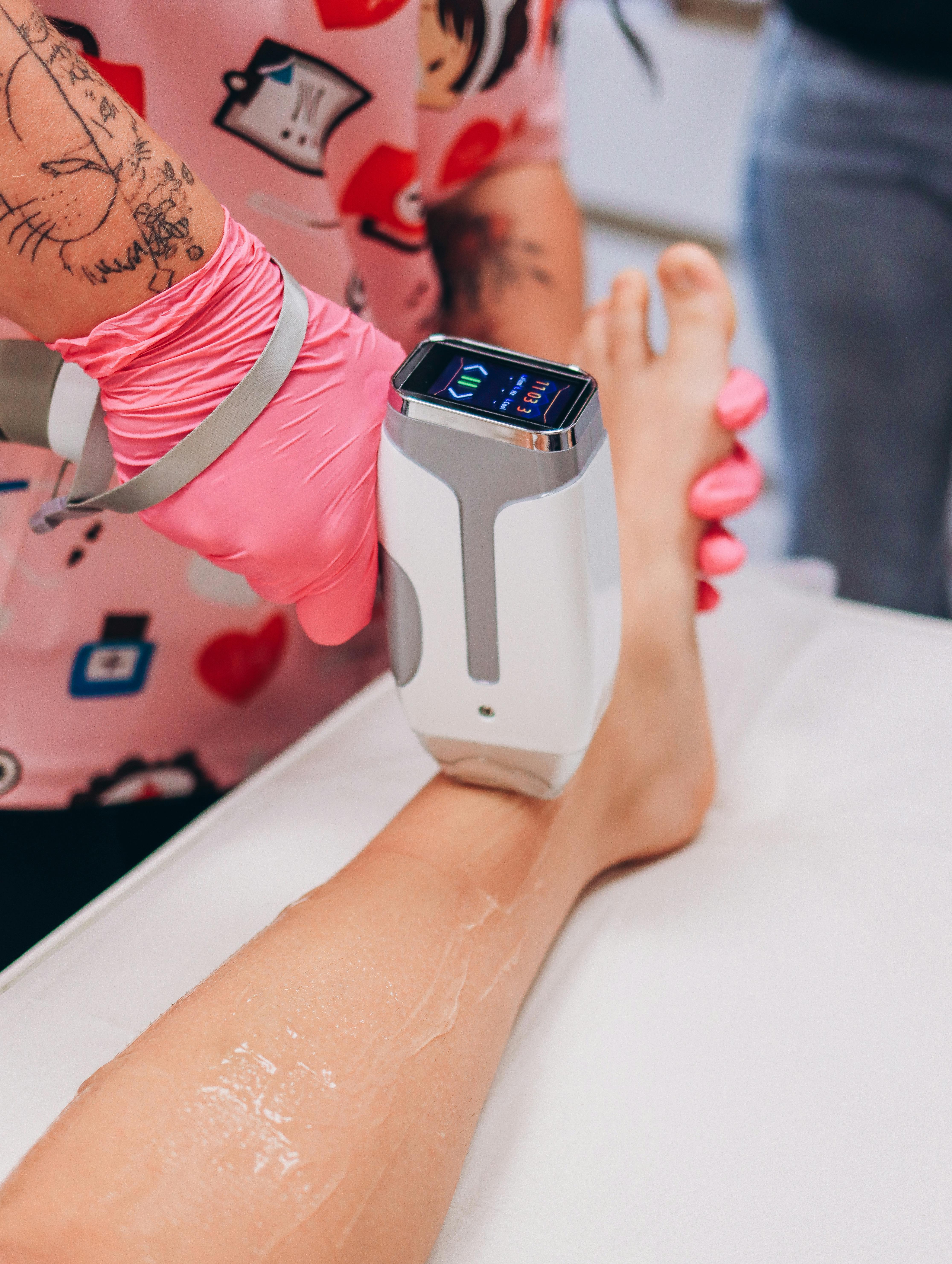 Close-up of a laser hair removal procedure on a client's leg, showcasing modern beauty treatment.