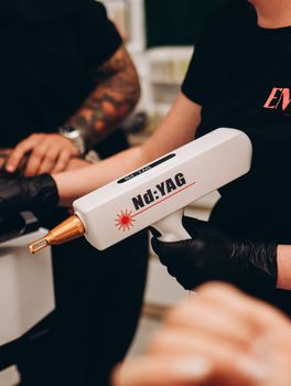 Close-up of Nd:YAG laser used in tattoo removal procedure at a clinic in Poland.
