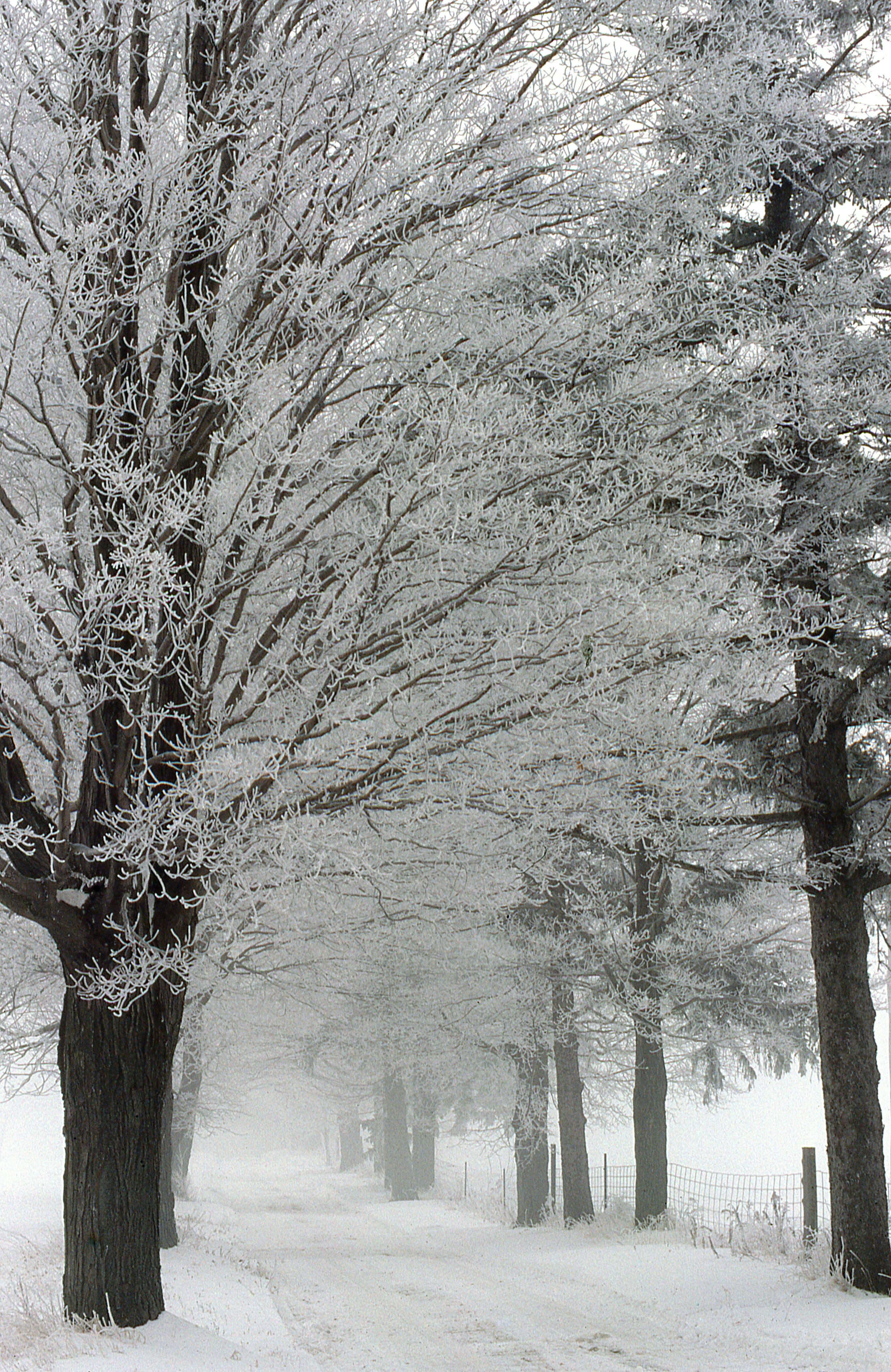 51 Ways To Cope With Frozen Shoulder Tips