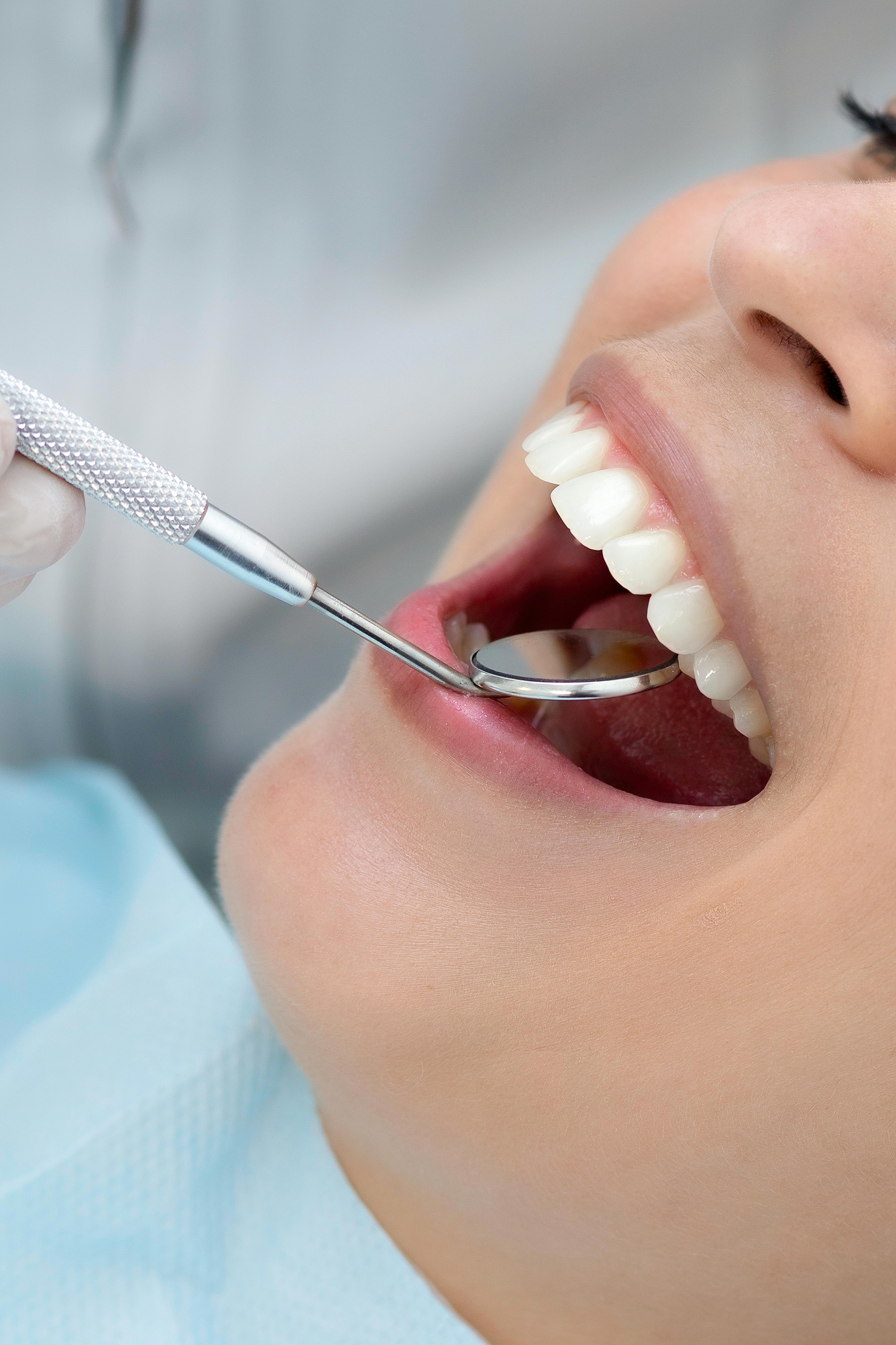 Free A detailed view of a dental check-up at a clinic in Belo Horizonte, Brazil. Stock Photo