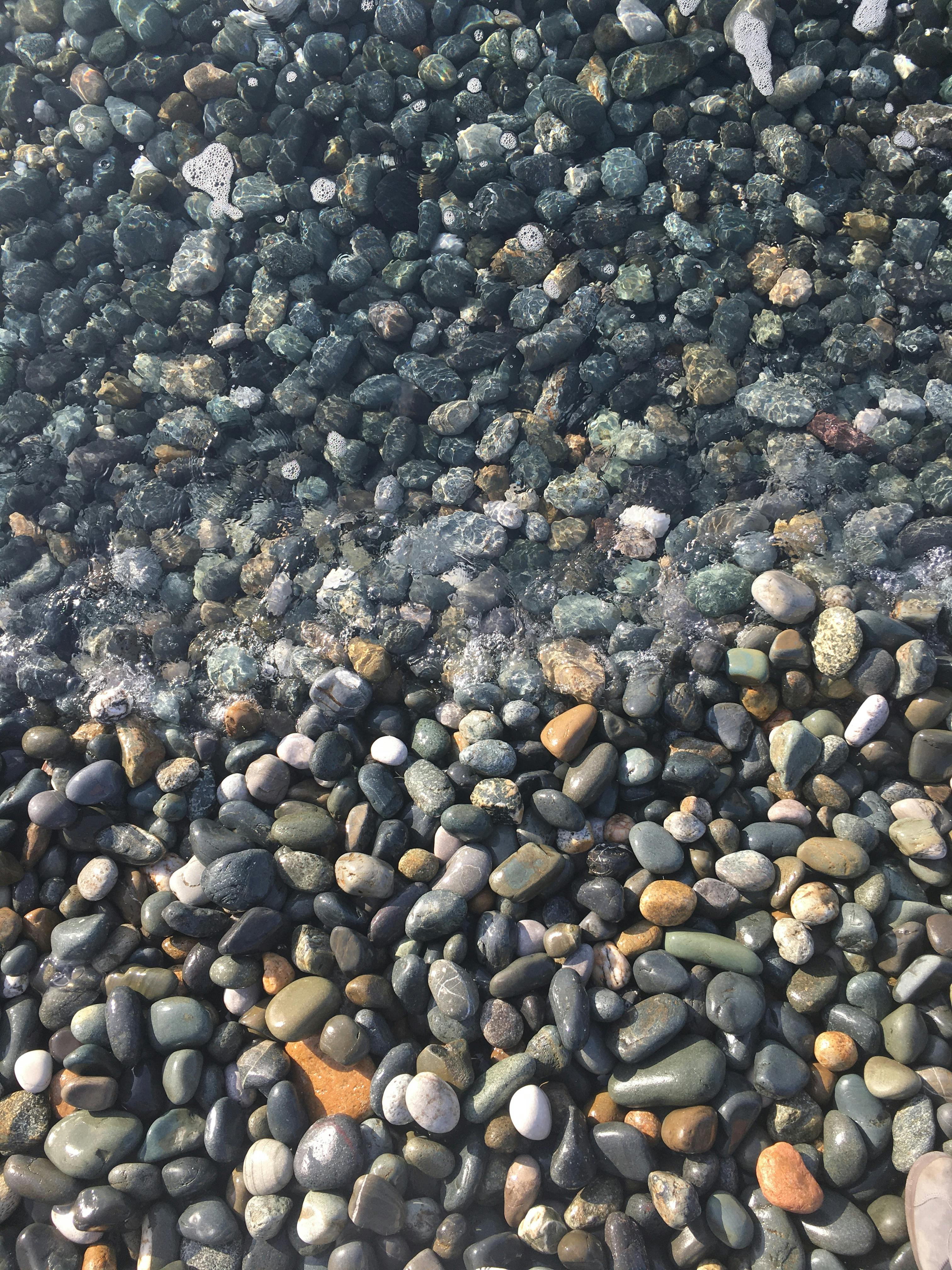 51 Kidney Stones Tips