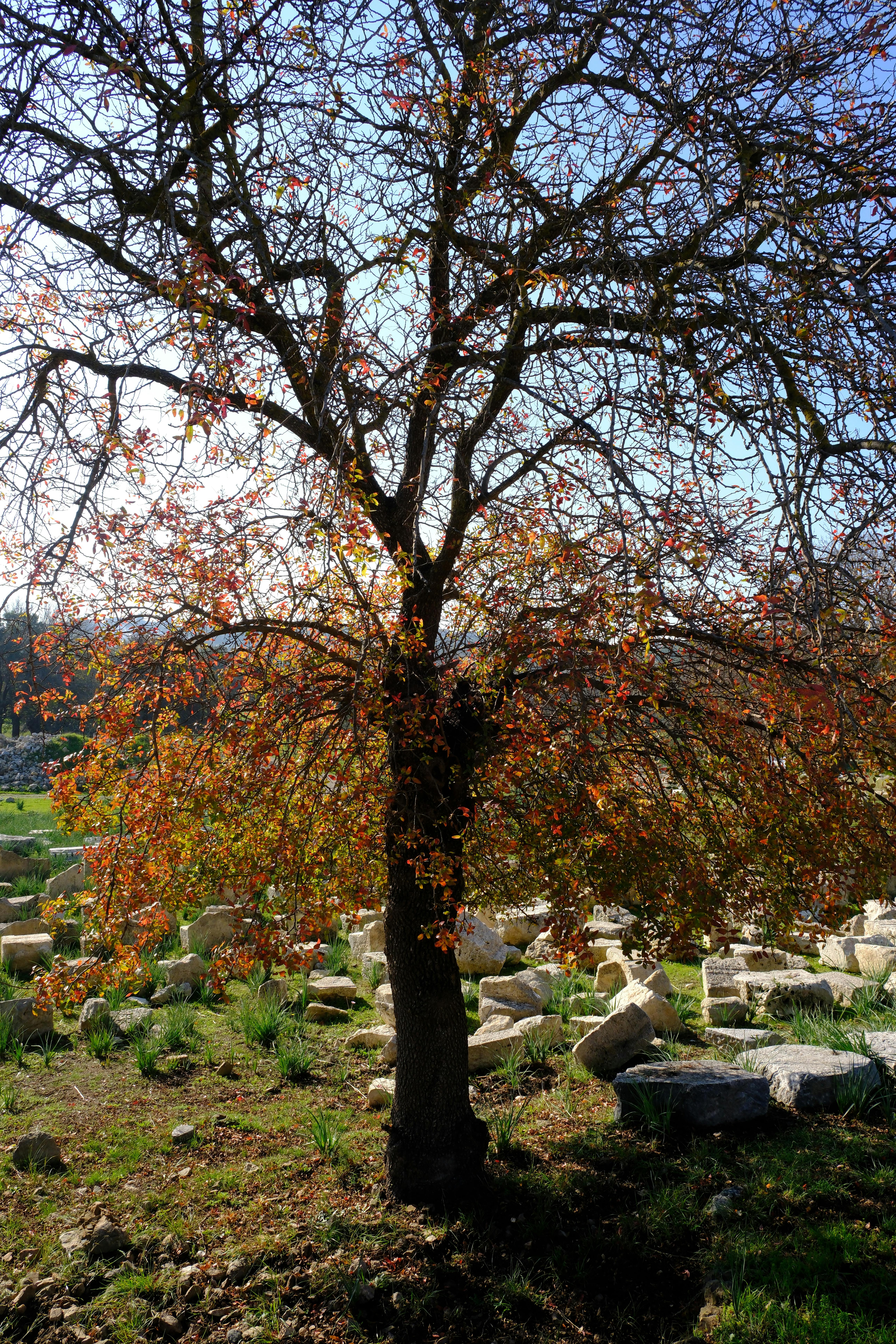 51 Kidney Stones Tips