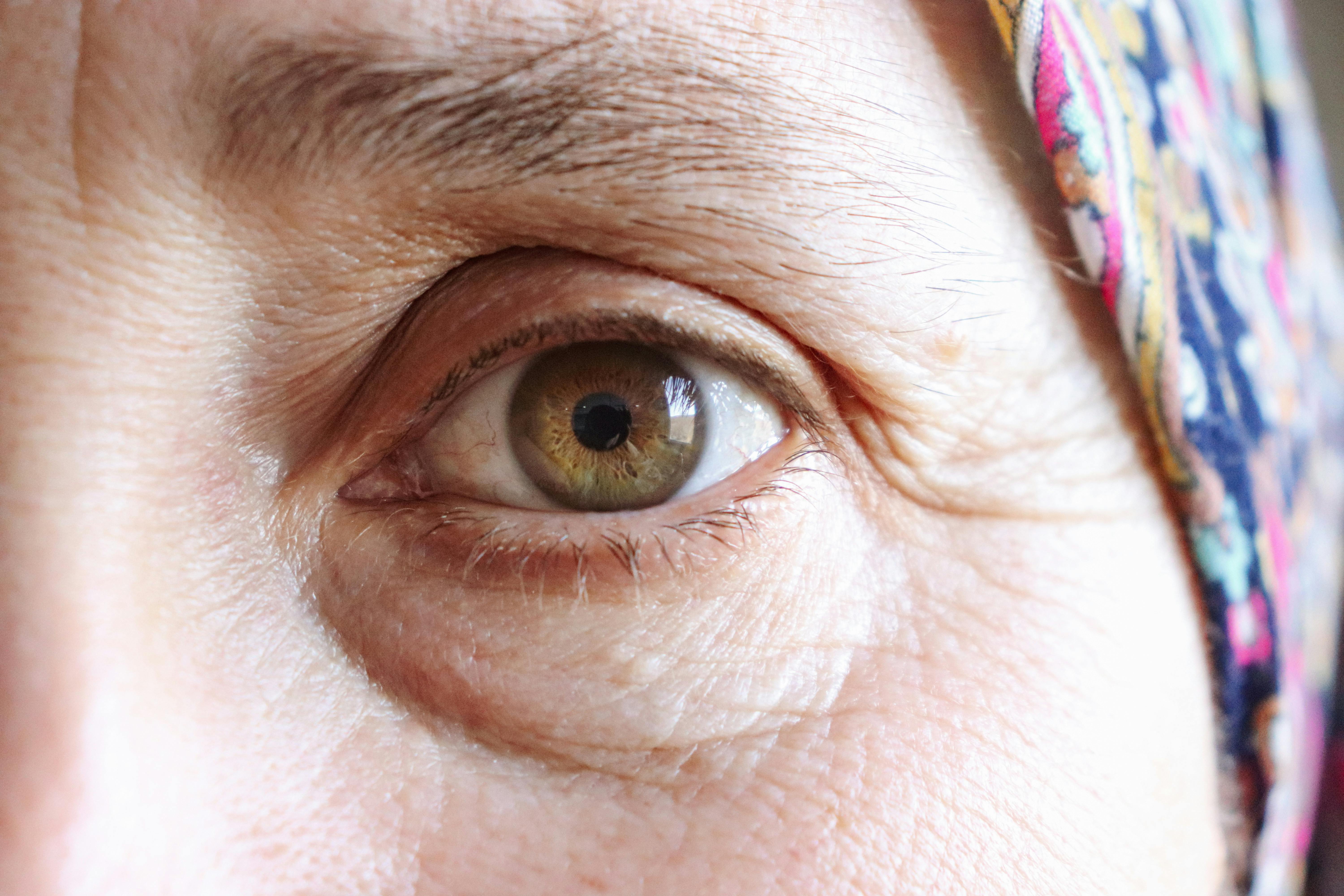 Pogoste napake pri negi oči, ki lahko povzročijo dolgoročne težave