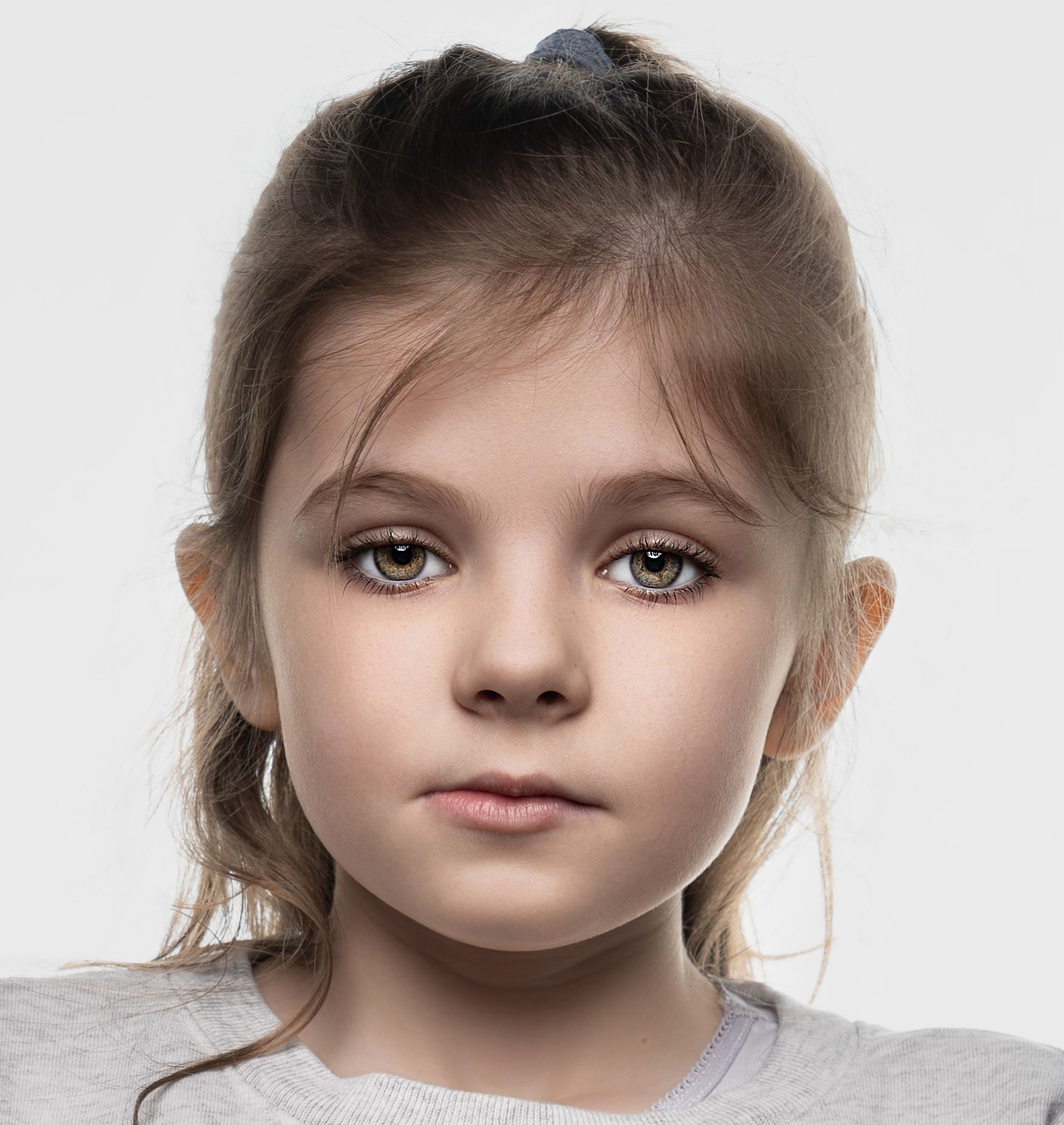 H50.4: Other and Unspecified Heterotropia - Panduan Lengkap