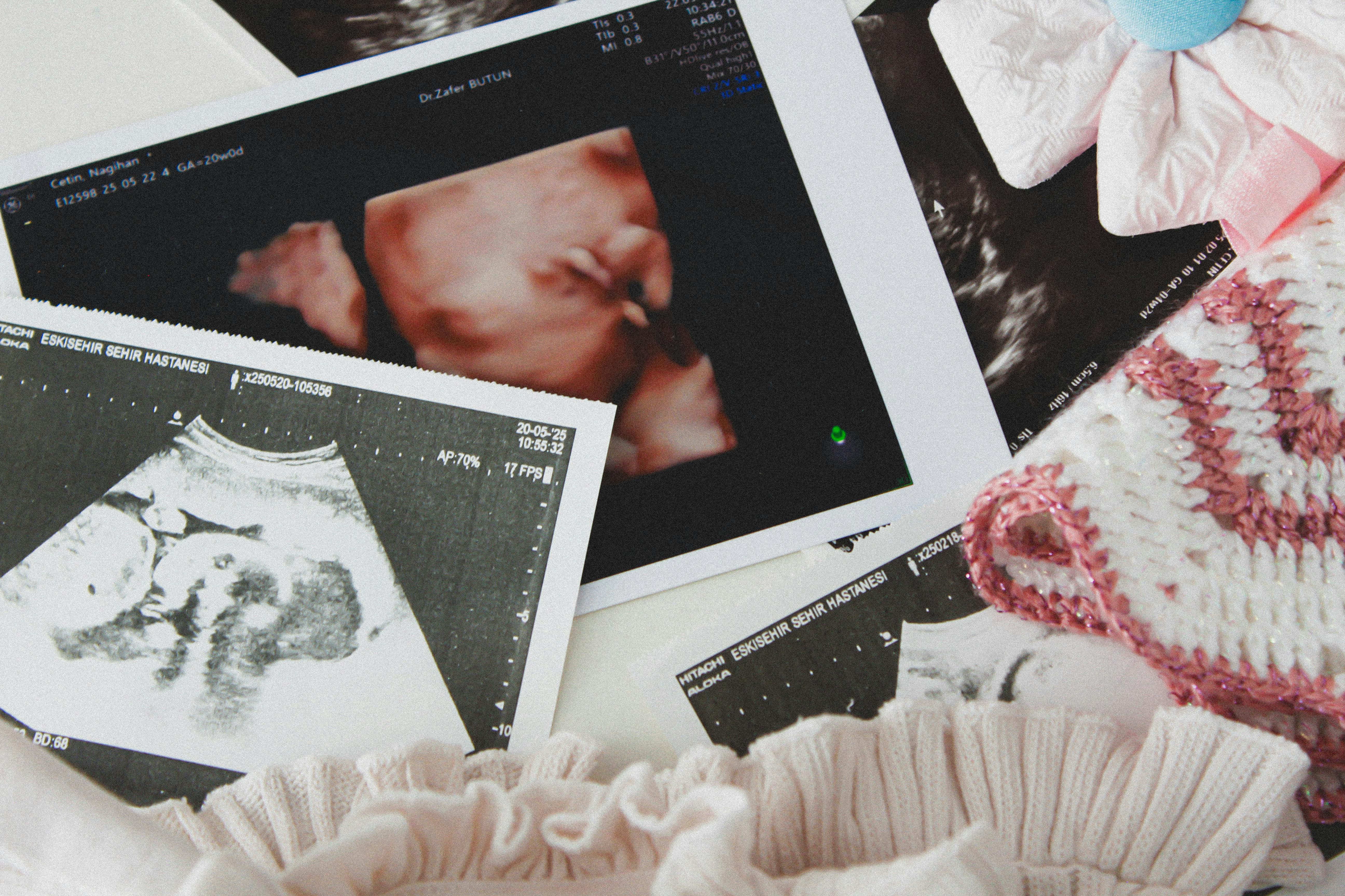 Female sonographer performing an elective 3D ultrasound scan, focused on the monitor in a professional studio