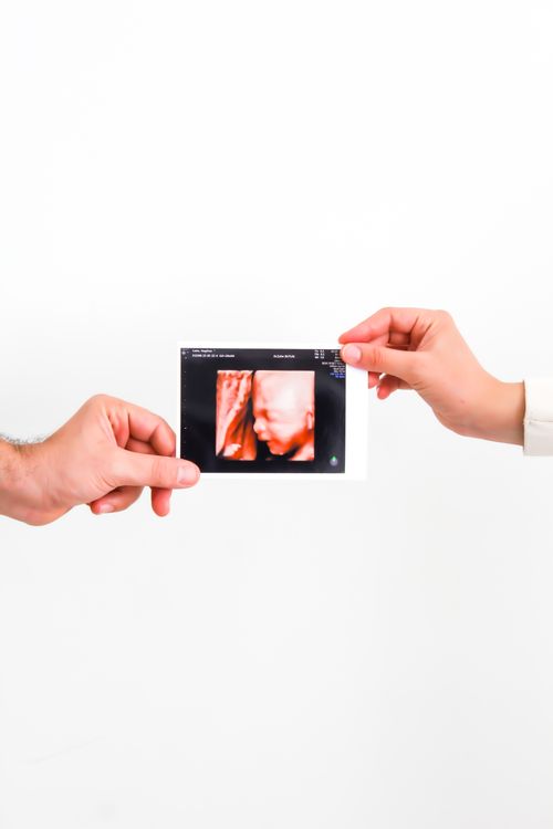 Free A close-up of hands holding an ultrasound image of a baby on a white background. Stock Photo