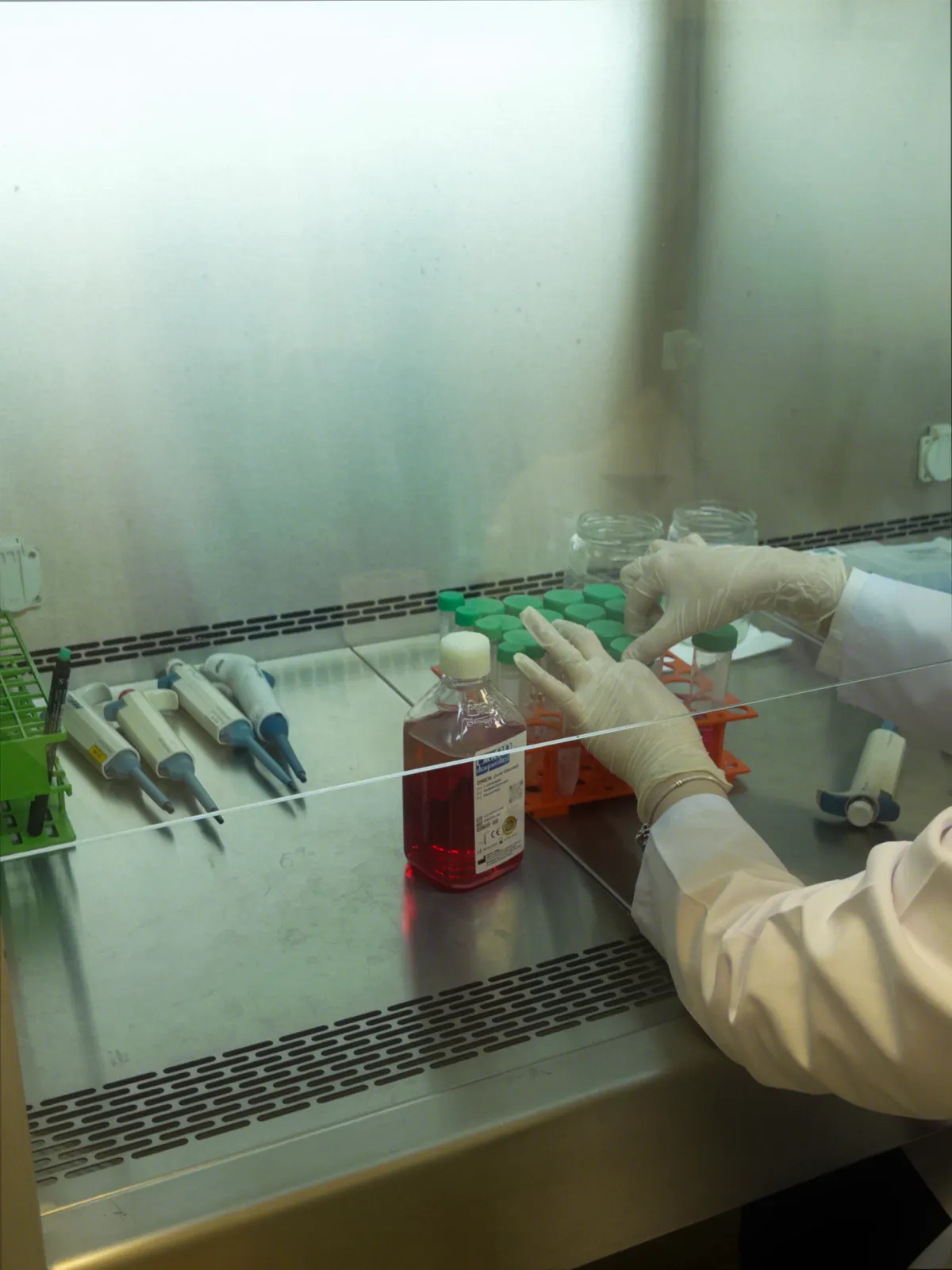 Autologous Stem Cell Therapy: Is Fresh or Frozen Better for Recovery?