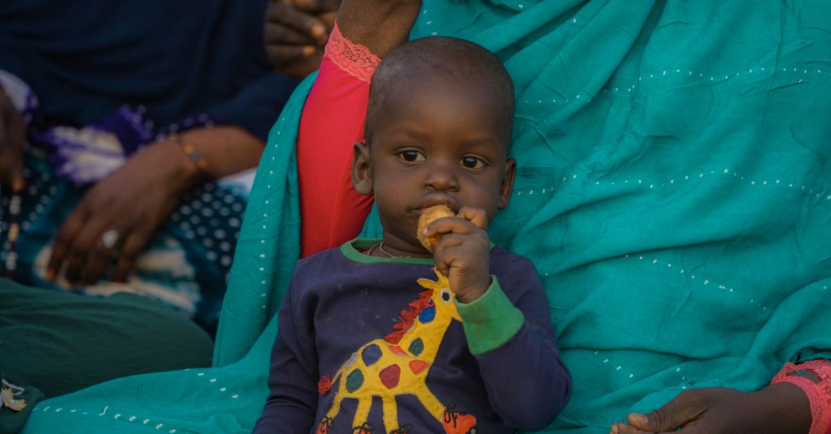 Why Is Malnutrition a Concern in Chronic Obstructive Pulmonary Disease