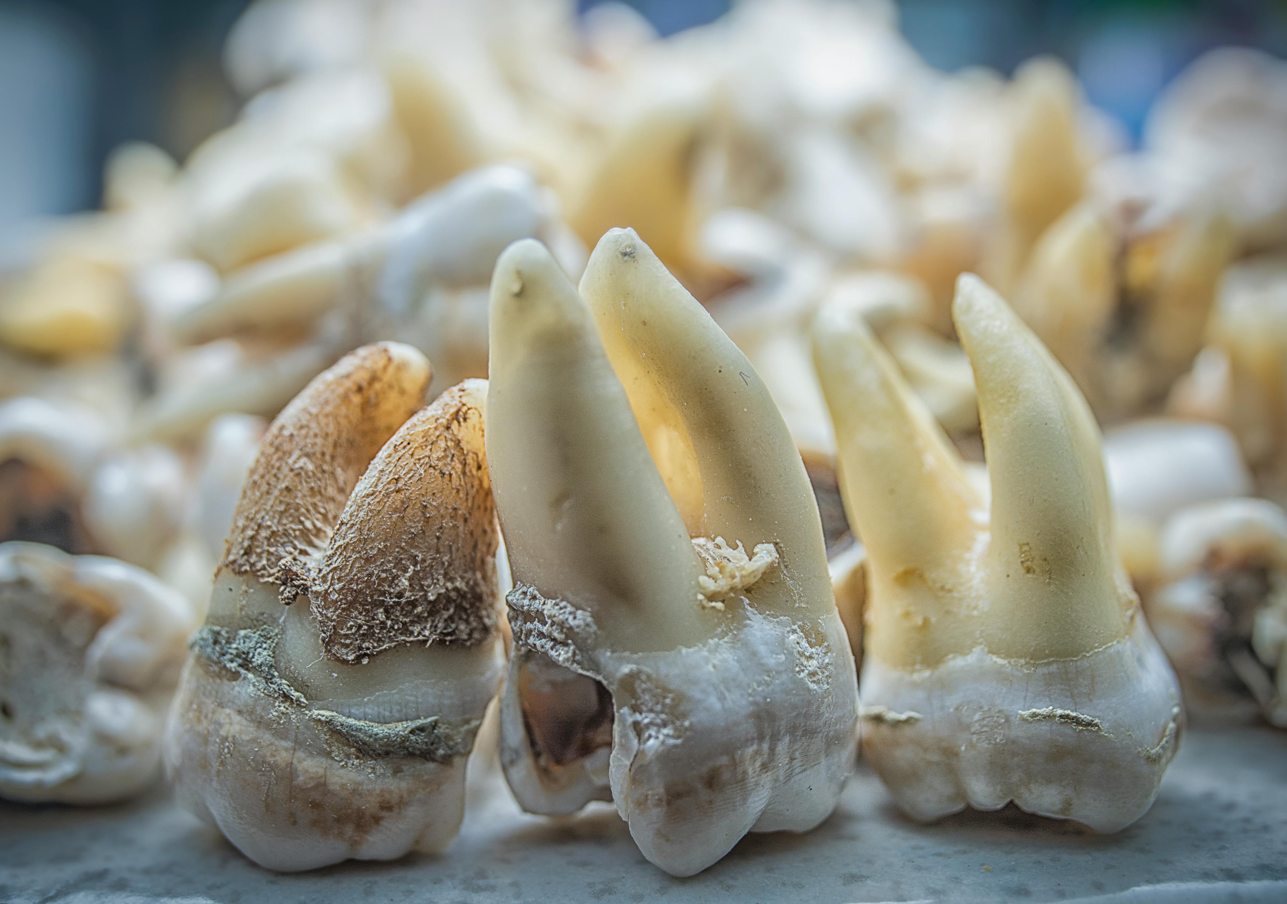 Detailed macro shot of decaying human teeth, showcasing cavity and dental issues.