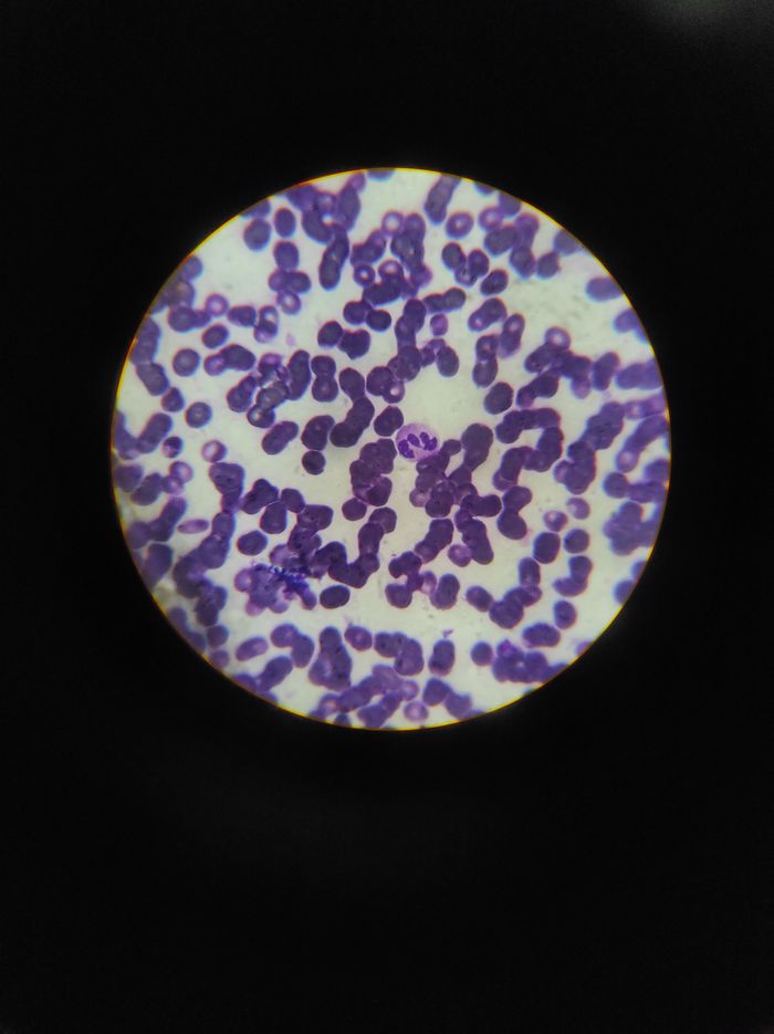 Stained white blood cells seen under the microscope, carriers of the immune repertoire