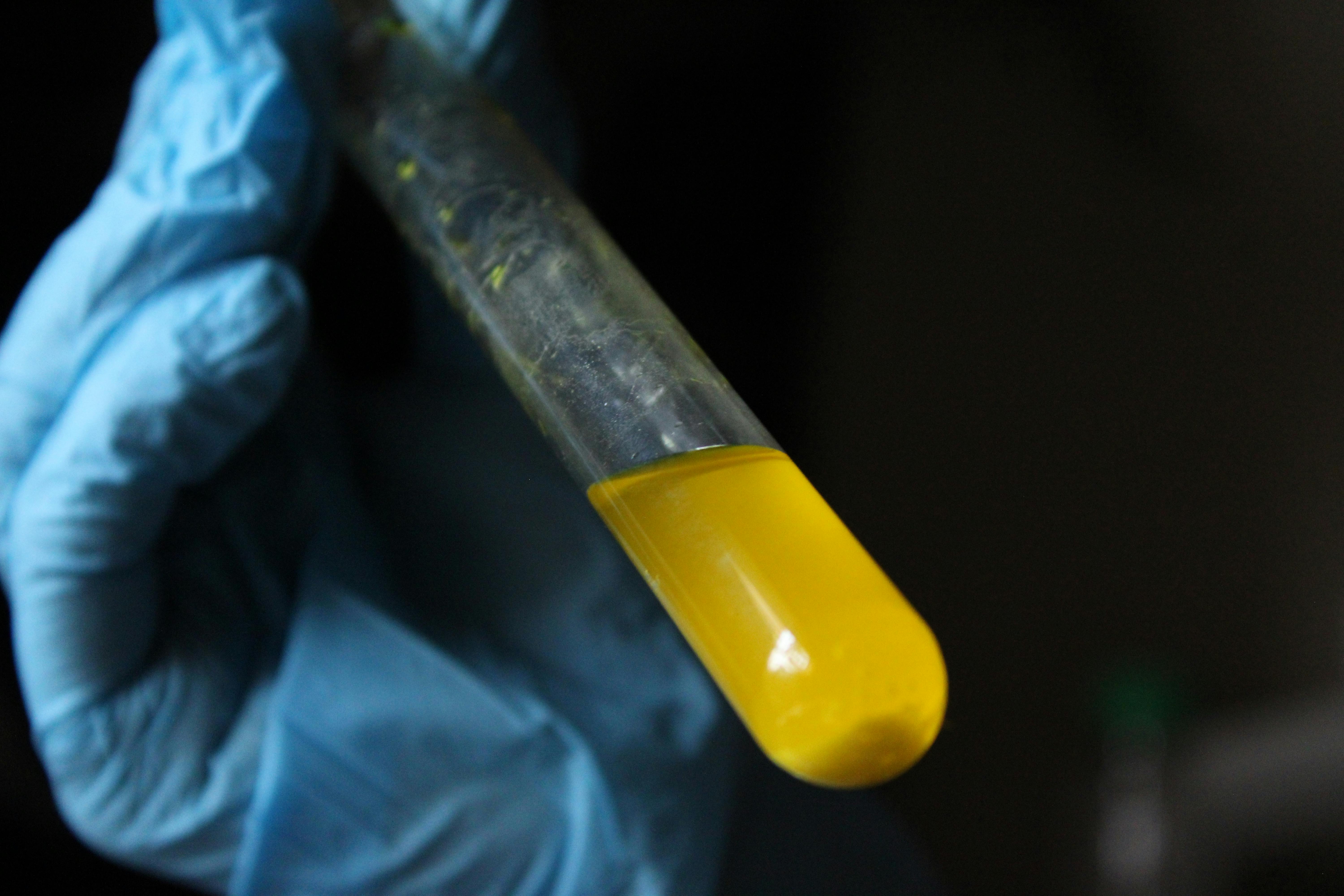 Longevity Science Is Overhyped. But This Research Really Could Change Humanity. — Photo by Jahra Tasfia Reza on Pexels