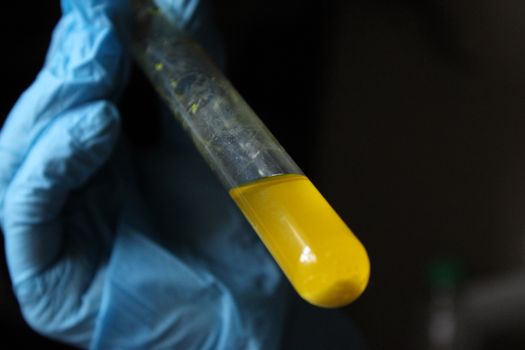 A gloved hand holds a test tube filled with yellow liquid, symbolizing scientific research.