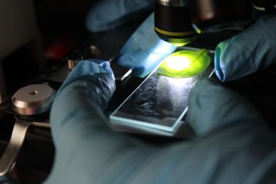 Gloved hand positioning a smear slide under the microscope light