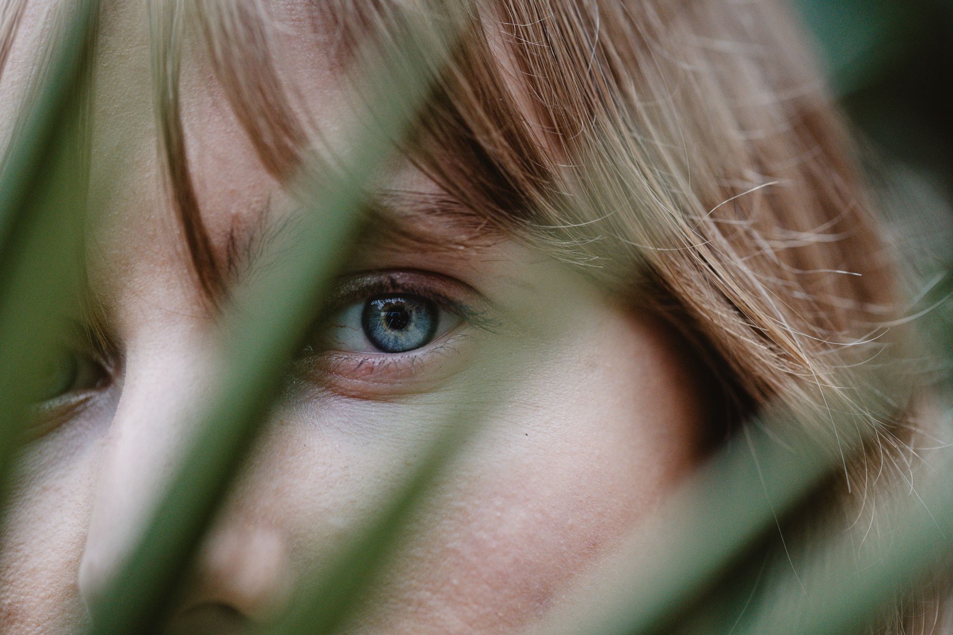 Retinal Migraine vs. Ocular Migraine: Understanding the Differences
