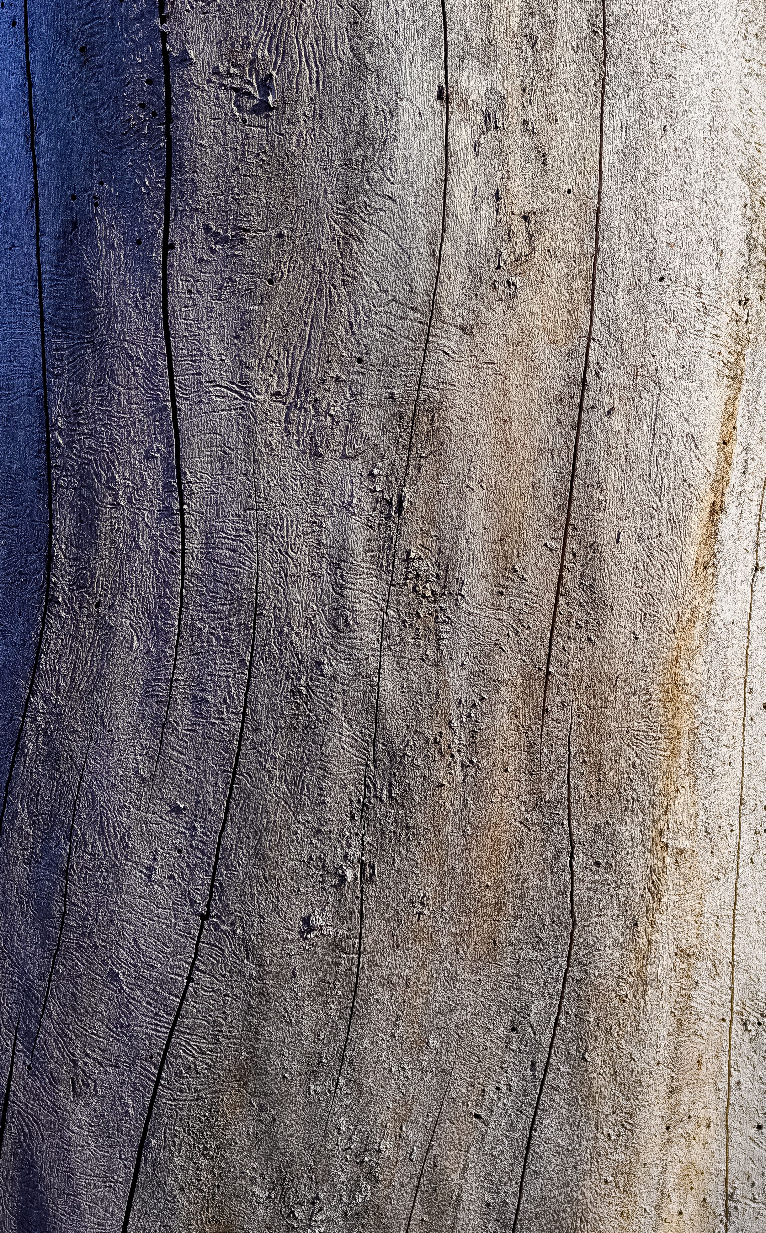 Striae Atrophicae (L90.6): Penyebab, Gejala, Diagnosis, dan Penanganan