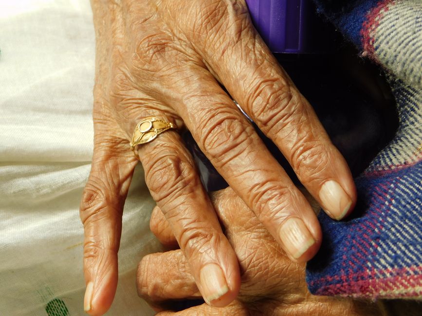 Scientists discover a two-stage aging process that may cause cancer and arthritis