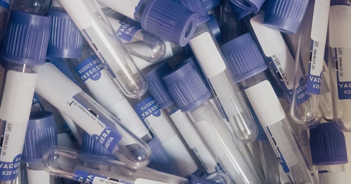 A collection of labeled laboratory test tubes used for medical sample analysis