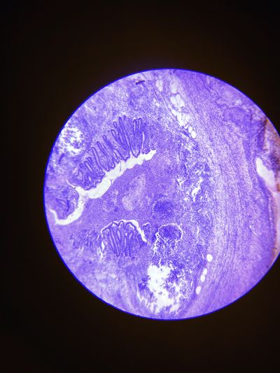 Purple-stained tissue section seen through the microscope eyepiece