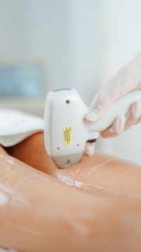 Laser treatment session