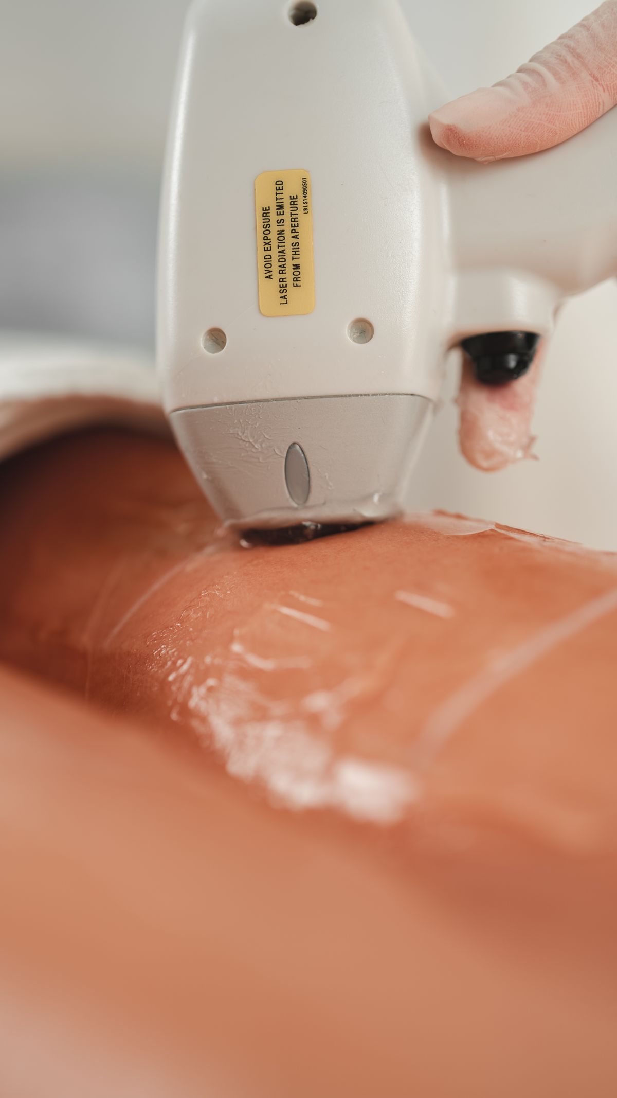 Bikini Laser