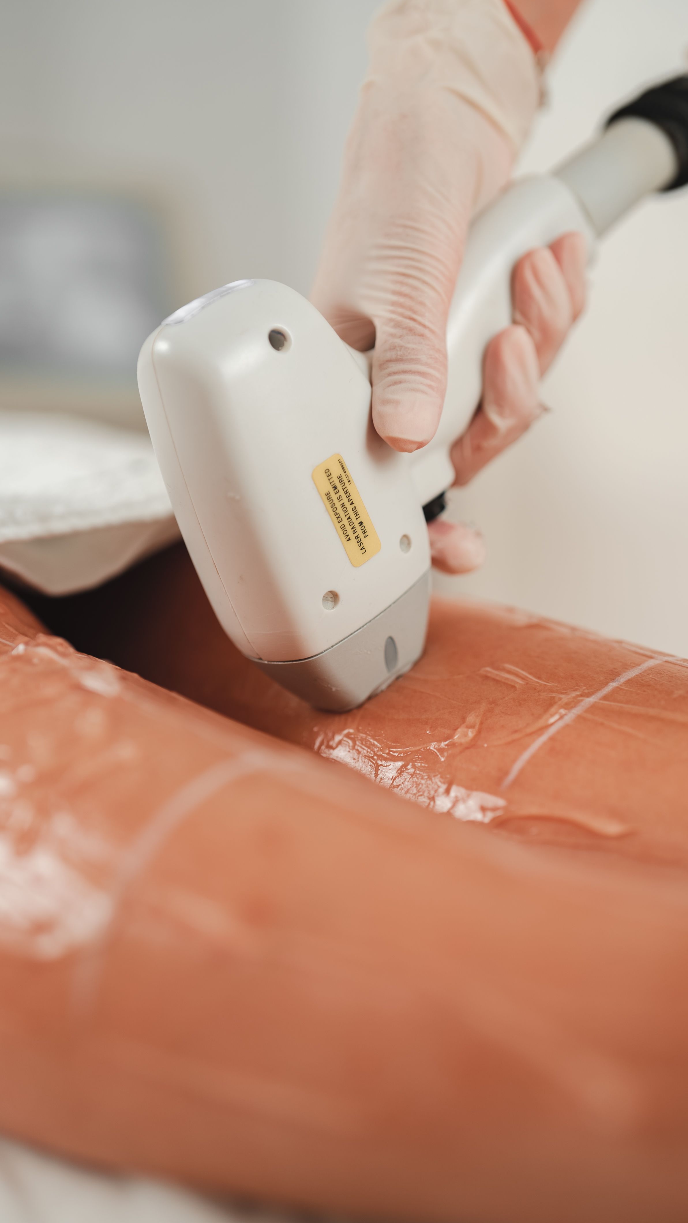 Close-up of laser hair removal process on leg in a beauty clinic, showcasing advanced cosmetic technology.