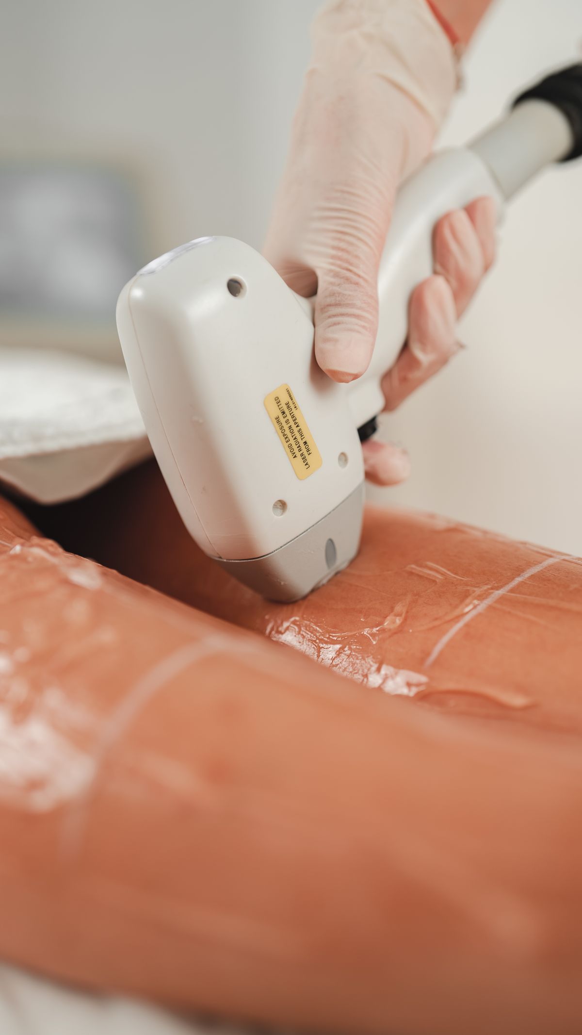 Beauty professional using a modern light-based hair removal device