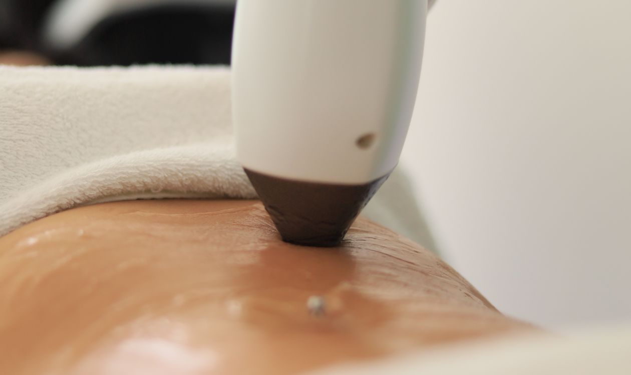 Detalle de cabezal láser sobre la piel en consulta de estética, Sapphira Privé Montecarmelo