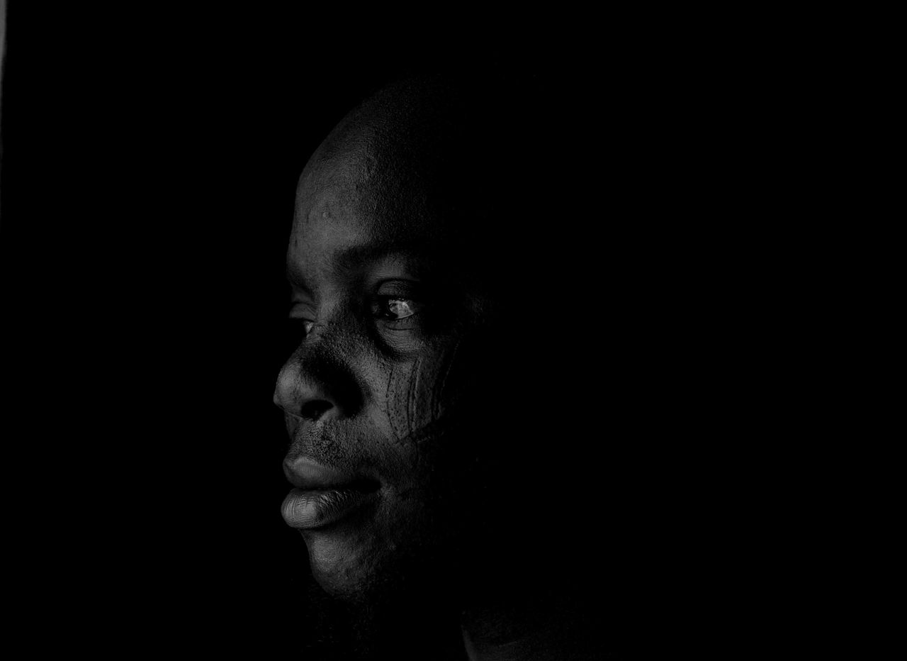 black and white of african american male with scar on face looking awa