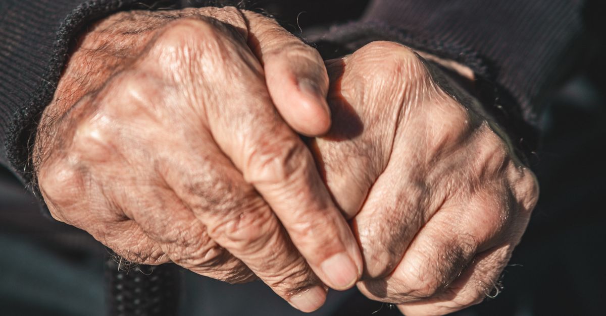 Study Links Psoriasis Immune Rhythms to Disease Severity