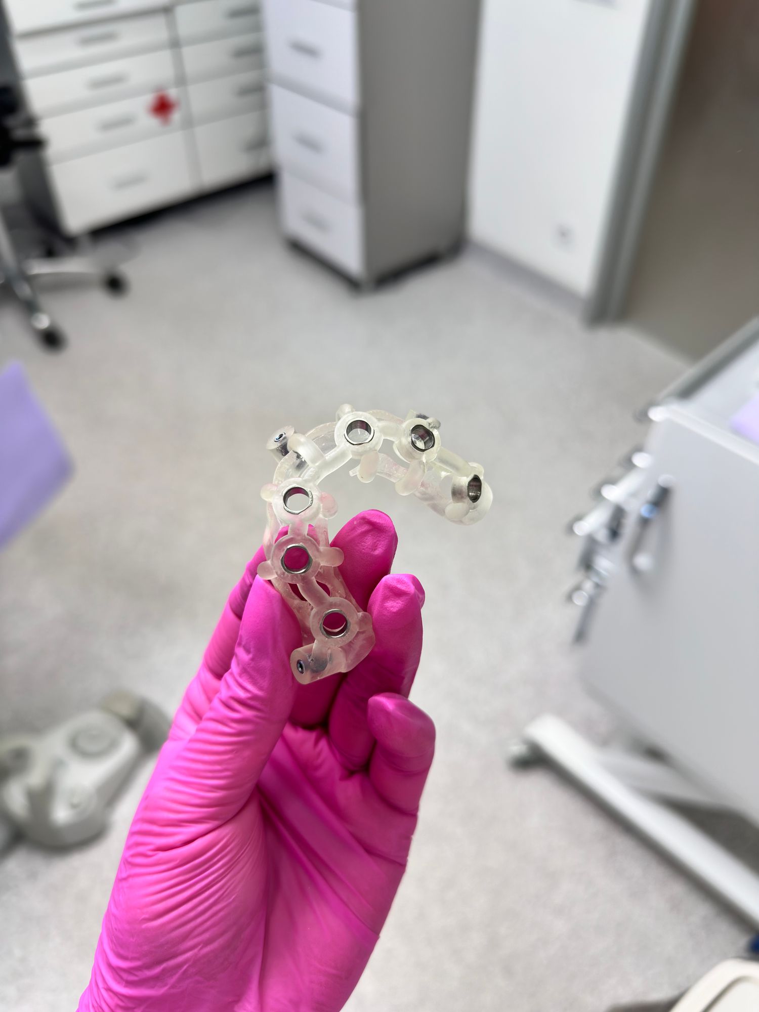 Guide chirurgical personnalisé, conçu à partir de la planification numérique