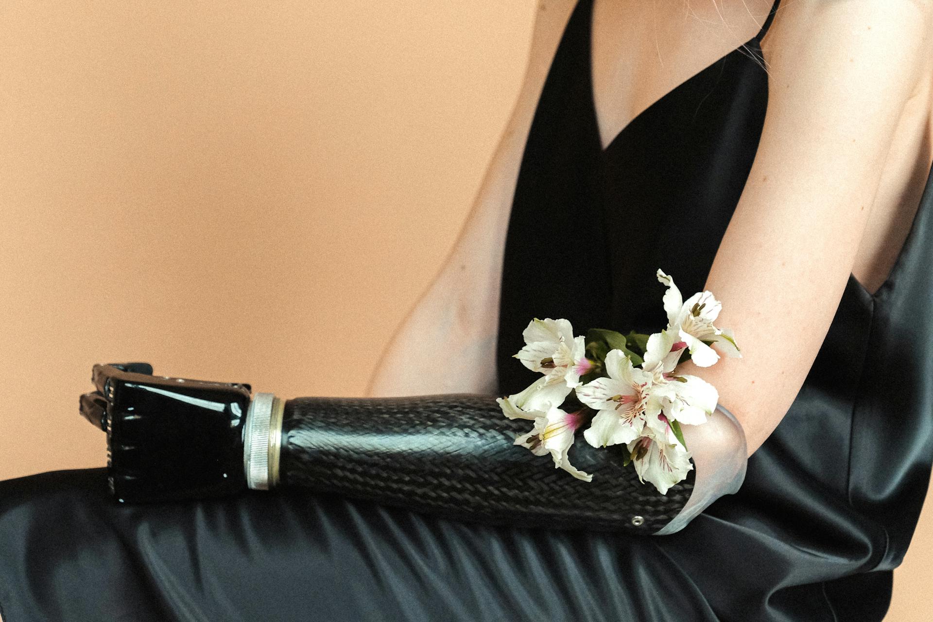 Woman in black dress with prosthetic arm decorated with white flowers, showcasing grace and resilience.