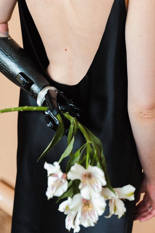 Free Rear view of a woman in a black dress holding white flowers with a prosthetic arm. Stock Photo