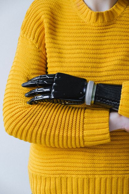 Close-up of a prosthetic arm crossed over a yellow knitted sweater, highlighting modern assistive technology.