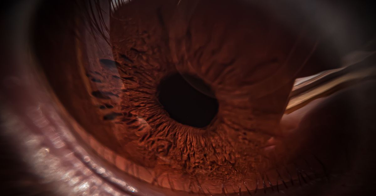 AIIMS Expands Cornea Retrieval Network with New Hospital Partnerships