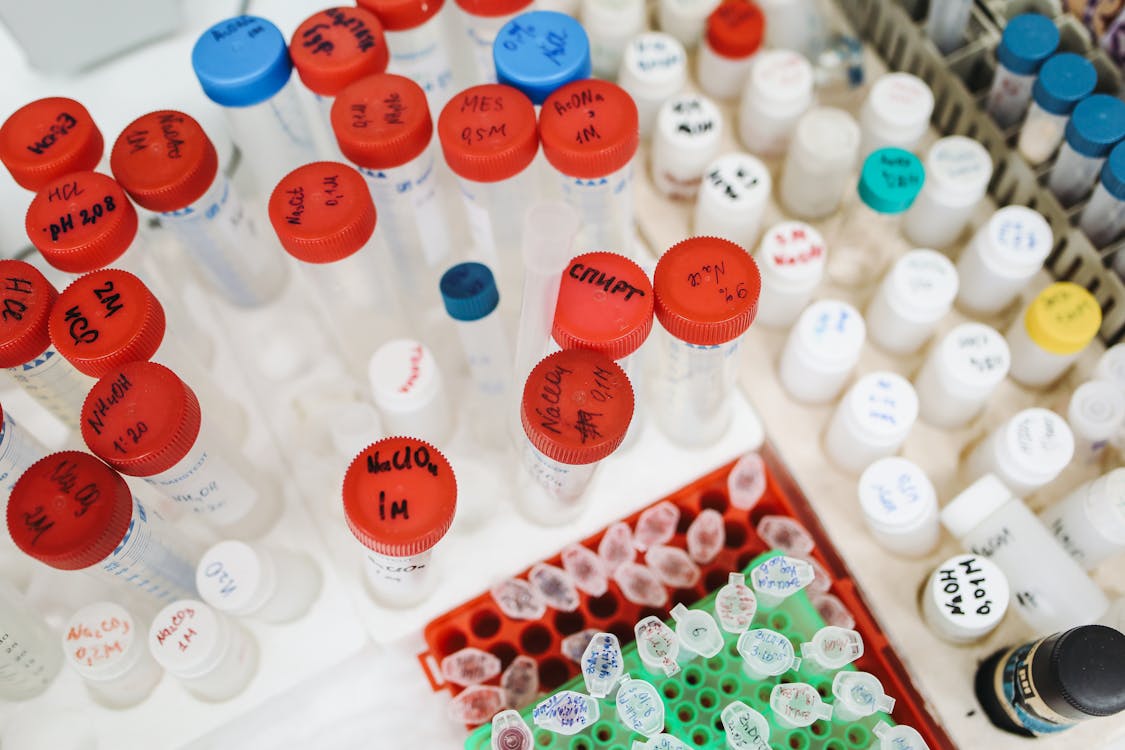 Toma de muestras a domicilio en Bogotá - Laboratorio clínico a domicilio SMD Vital