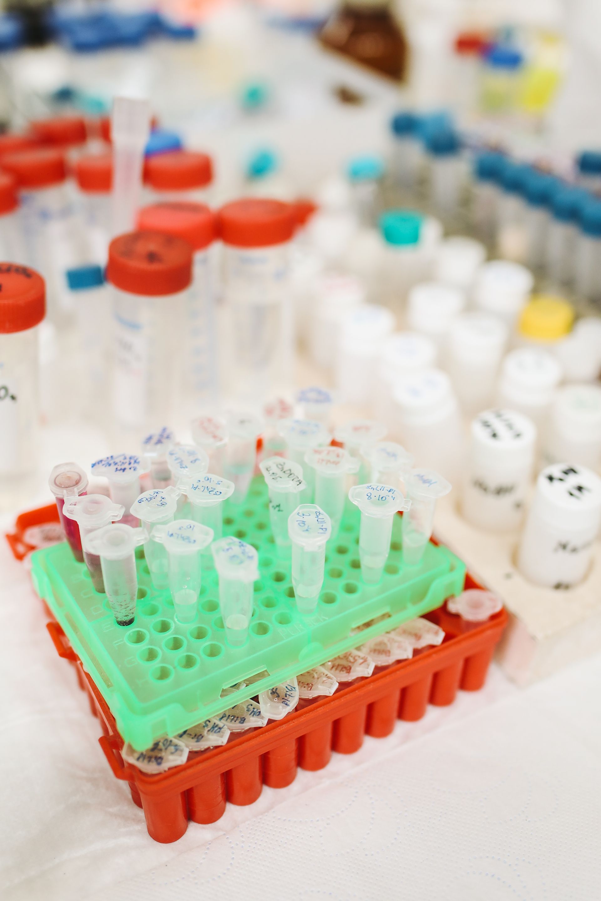 Test tubes in a diagnostic laboratory