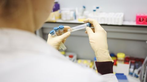 Cellular Wellness: Deconstructing the Science of continuous glucose curves
