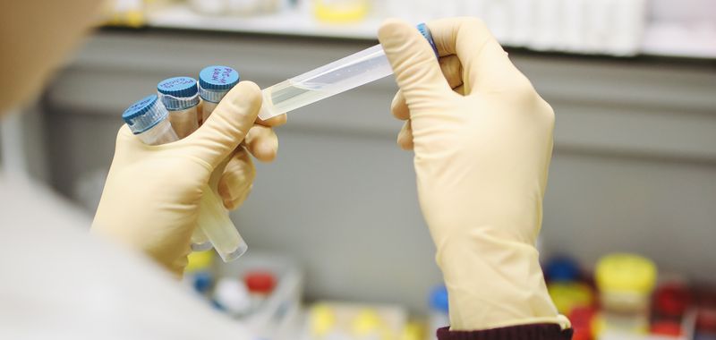 BPC-157 Reconstitution Guide for Researchers BPC-157 vial reconstitution steps — bacteriostatic water being added to lyophilised peptide powder in research setting