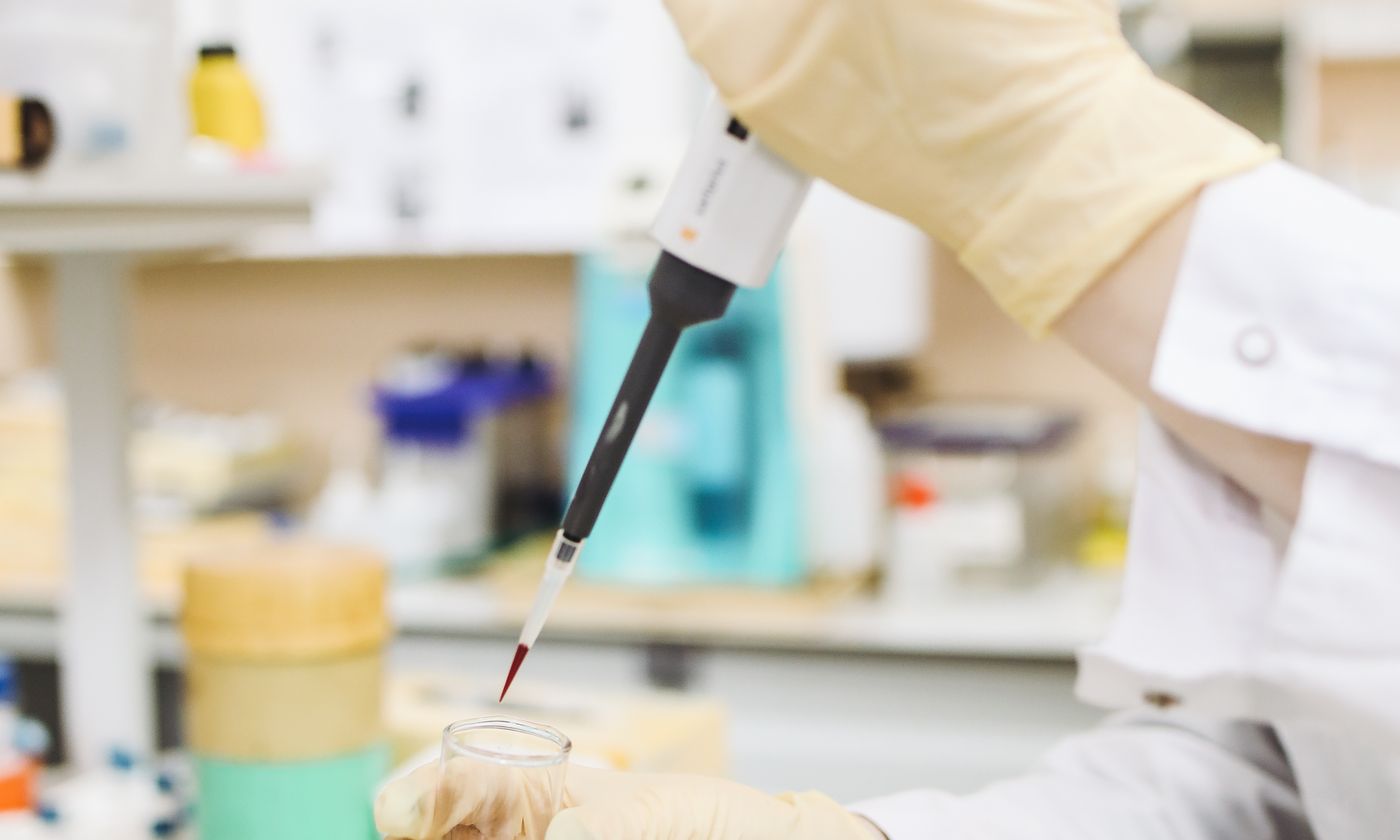 Scientist handling a colored laboratory sample