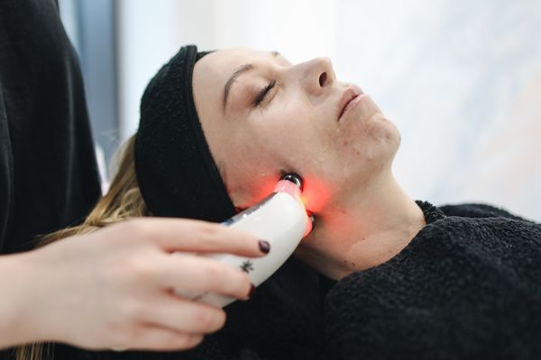 Photofacial result