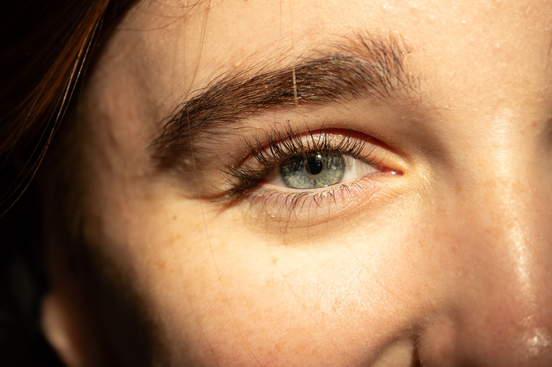 Close-up of a human eye in natural light showing the thin, delicate skin of the eyelid area