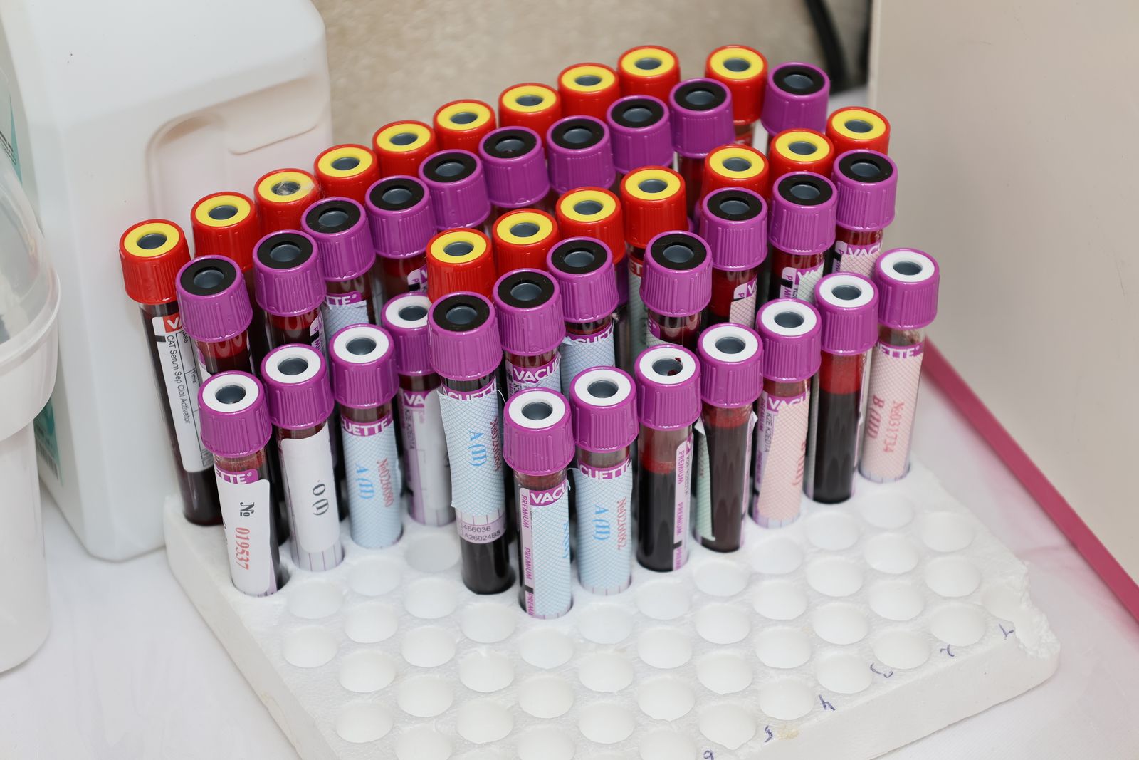 A rack of blood samples in labeled collection tubes at a testing laboratory.