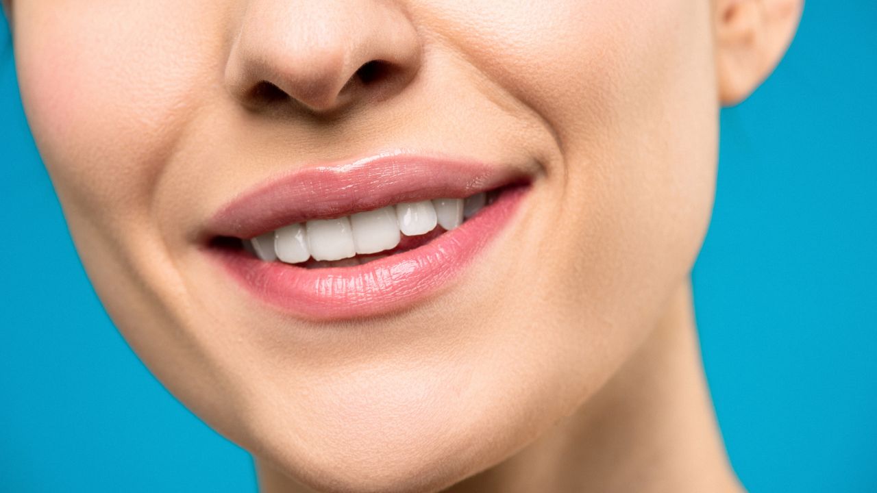 Preenchimento Bigode Chinês em Bauru: Riscos, Cuidados e Resultados Naturais - Augusta Perfection