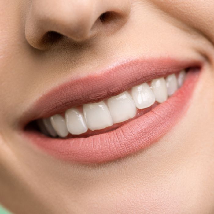 Resultado de tratamiento dental: sonrisa sana